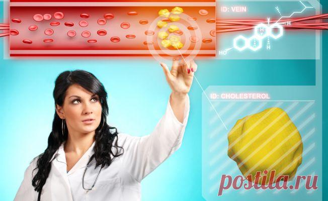 10 фактов о холестерине, которые вы не знали | ВитаПортал - Здоровье и Медицина