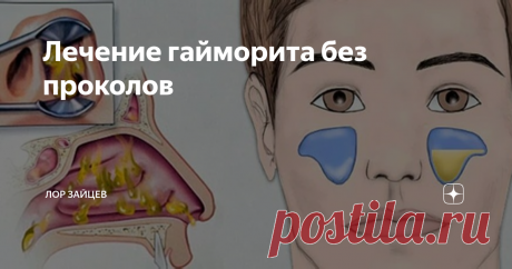 Лечение гайморита без проколов Пункция (или прокол) при гнойном гайморите — это страшный сон большинства пациентов. За долгие годы процедура обросла стольким количеством мифов и легенд, что страх больного, что ему сделают прокол пазух, заставляет его оттягивать визит к лор-врачу. А между тем теряется драгоценное время, когда возможно бы было вылечить гнойный гайморит консервативно и обойтись без прокола. Какие же современные ме