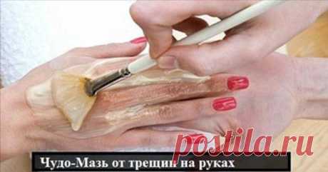 Чудо-мазь от трещин на руках » В сети – себя просвети! - Развлекательный портал!