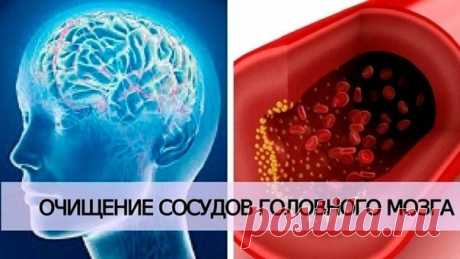 Очищаем сосуды головного мозга

Всем известно, что очистка внутренних органов необходима, чтобы избавиться от токсинов, шлаков, камней, песка, наростов кальция и других вредных вещей, которые накапливаются в нашем организме в процессе жизнедеятельности.

Чистка сосудов головного мозга: фитотерапия и народные методы лечения
Показать полностью...
