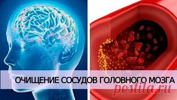 Очищаем сосуды головного мозга

Всем известно, что очистка внутренних органов необходима, чтобы избавиться от токсинов, шлаков, камней, песка, наростов кальция и других вредных вещей, которые накапливаются в нашем организме в процессе жизнедеятельности.

Чистка сосудов головного мозга: фитотерапия и народные методы лечения
Показать полностью...