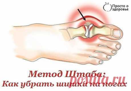 Метод Штаба: Как убрать шишки на ногах.Так уж сложилось, что косточки на ногах, или шишки, являются чисто женской проблемой. У мужчин шишки на ногах не растут потому что мышцы мужских ног одновременно мощнее и жилистее. Шишки на ногах - причины появленияНедавно с этой проблемой в больницу отправлась моя мама. Шишки на ногах у нее так разболелись, что она сутки лежала охая, но все мои рецепты первоначально отвергла напрочь, потому что она "человек старой формации и доверяет врачам." Визит к докто