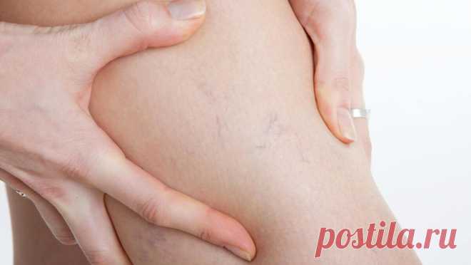 Противопоказания к применению компрессии | Lauma Medical | Дзен