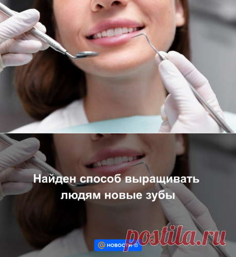 Найден способ выращивать людям новые зубы | 18 июля 2023 - Новости Mail.ru