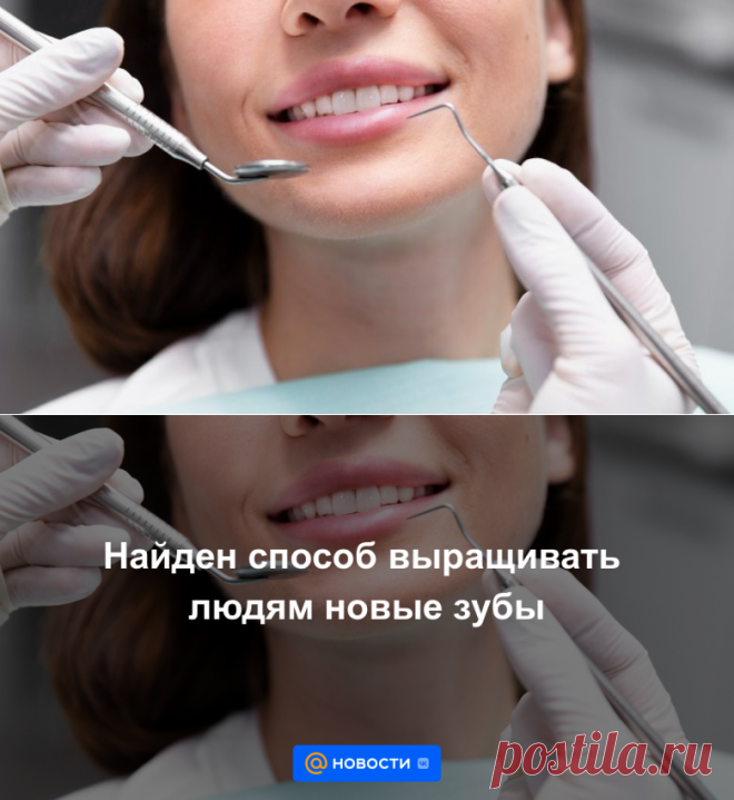 Найден способ выращивать людям новые зубы | 18 июля 2023 - Новости Mail.ru