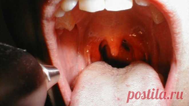 Этому трюку 400 лет и он доказал свою эффективность! В его эффективности сомневаются только те, кто не пробовал его применять! Мы применяем его всей семьёй уже много лет и он ни разу нас не подвёл! — Полезные советы