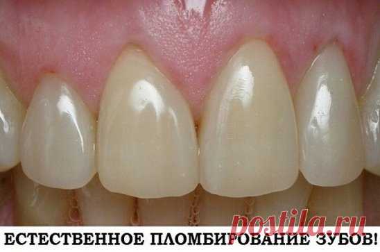 Естественное пломбирование зубов! 
Это очень действенное народное средство лечения зубов. 
Аир проникает в корни зубов и обезболивает их, а прополис пломбирует все микротрещины. Зубы естественным путём полностью исцеляются!
Возьмите пол-литра водки 40% и всыпьте туда полстакана корней аира. Это первый настой.Для приготовления второго: возьмите ещё пол-литра водки 40% и всыпьте 15-20 грамм растёртого прополиса.Оба настоя настаивать 7-10 дней.Обе настойки применяют одновременно.Смешайте одну ст