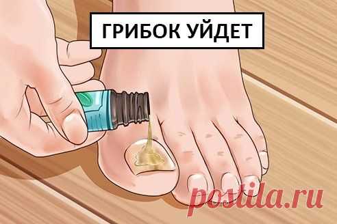 Народные методы лечения грибковых инфекций на ногтях: 7 лучших рецептов Грибок ногтей — инфекционное заболевание, по причине которого ногти на ногах начинают крошиться, расслаиваться, темнеть и приобретают нездоровый вид. Со временем грибок с ногтей может «перекинуться» на кожу стоп и пойти дальше «гулять» по организму...