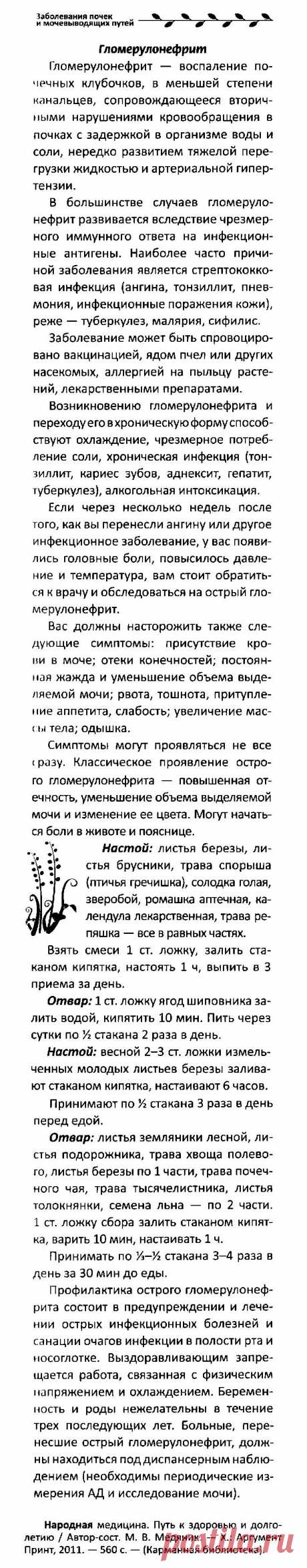 Гломерулонефрит