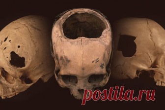 Древние инки проводили операции на черепе лучше, чем хирурги XIX века - Телеканал «Наука»