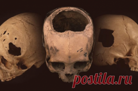 Древние инки проводили операции на черепе лучше, чем хирурги XIX века - Телеканал «Наука»