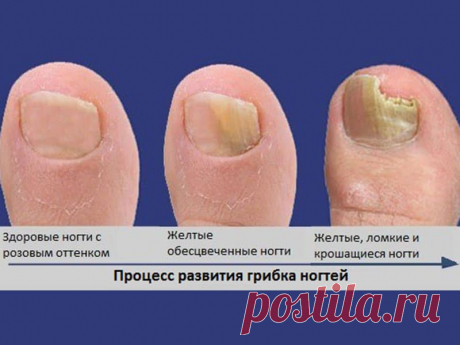 Помогите разоблачить Пантогор	Помогите разоблачить Пантогор. Привет пикабу, знаю что тут есть разоблачители гомеопатии, услышал как бабушка заказывала по телефону средство Пантогор, полазив в интернете не нашёл нечего адекватного про него только сайты с продажей и заказные видео на ютубчике.