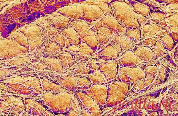 Что вы знаете о висцеральном жире | МОЙ ВОЗРАСТ