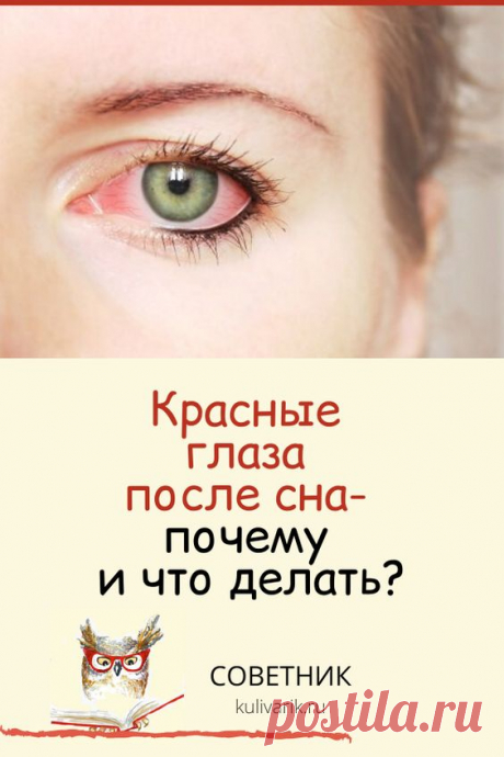 Красные глаза после сна: почему и что делать?