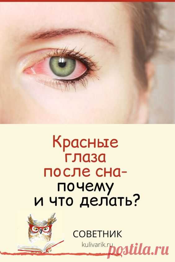 Красные глаза после сна: почему и что делать?