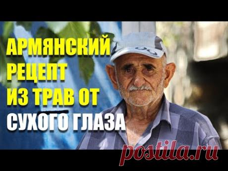 Пожилой армянин дал рецепт от сухого глаза и он помог!