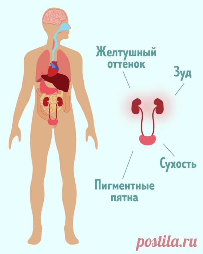 9 неочевидных симптомов, которые говорят о том, что с почками что-то не в порядке 
Большинство заболеваний почек может протекать без симптомов, что приводит к их позднему выявлению и даже переходу в разряд хронических. Различные недуги, связанные с почками, поражают до 14 % взросло…