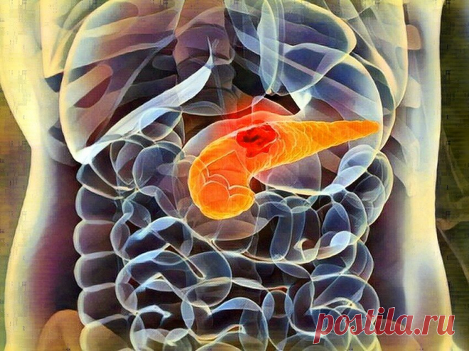 Ухаживаем за поджелудочной железой: 7 ключевых правил | Здоровый Дух | Яндекс Дзен