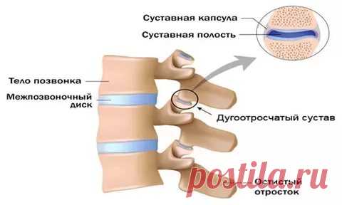 Артроз дугоотросчатых суставов