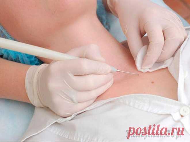 12 мифов о вирусе папилломы человека Вирус папилломы человека (или HPV – Human Papillomavirus) передается только от человека к человеку. По данным статистики в нашей стране 60 % населения инфицировано этим вирусом. И причиной такой широк...