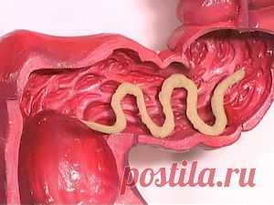 Как узнать что у тебя аскариды и как вылечить их?