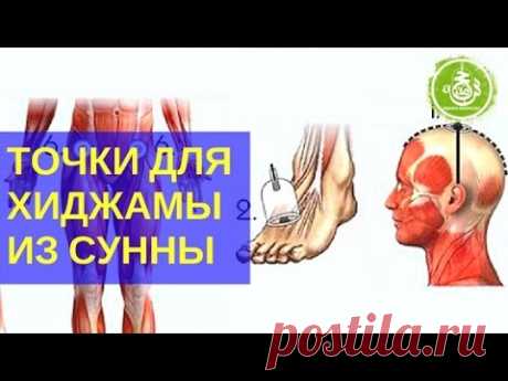 Точки для Хиджамы из Сунны | Обучение Хиджаме
