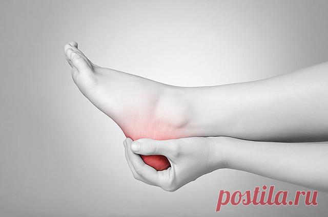 ЛЕЧЕНИЕ ПЯТОЧНОЙ ШПОРЫ