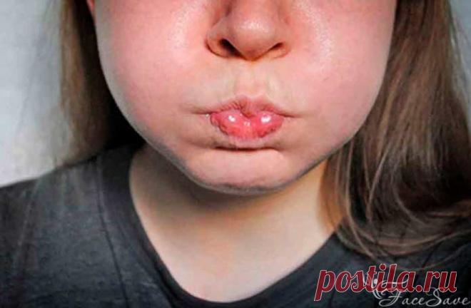 6 эффективных приёмов фейсбилдинга и самомассажа лица для тех, кому надоели бульдожьи щёчки | FaceSave.ru | Яндекс Дзен