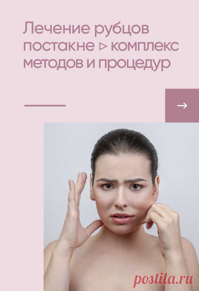 РУБЦЫ ПОСТАКНЕ ▷ ЭФФЕКТИВНЫЙ КОМПЛЕКС
👉 Как уменьшить атрофические рубцы постакне и избавиться от последствий угревой болезни?

‼️ Рубцы постакне являются самым неприятным последствием угревой болезни, поэтому комплексный и индивидуальный подбор программы лечения поможет выровнять рельеф кожи, избавиться от застойных пятен и рубцовых изменений.

Максимально быстрый эффект даст комплекс процедур:
✔️ Ретинол
✔️ Лазерная шлифовка
✔️ Плазмотерапия

📲 https://t.me/ClinicLitus