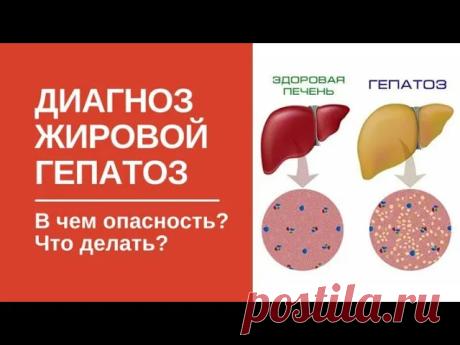Причины жирового гепатоза. Что такое "гепатоз печени"? Как избавиться?