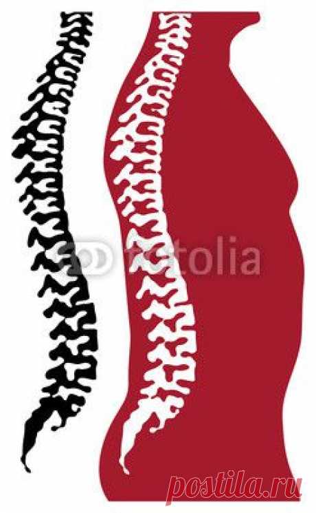 spine of the person из vadim0001. Роялти-фри вектор #65995216 на Fotolia.ru