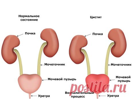 Частое мочеиспускание – лечение народными средствами, эффективные рецепты