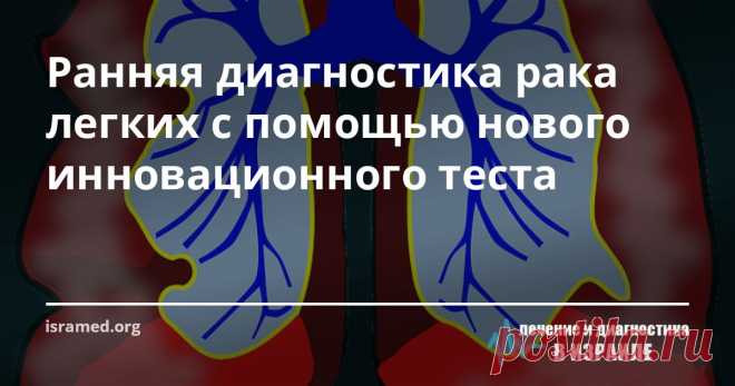 Ранняя диагностика рака легких с помощью нового инновационного теста Компания Savicell из нашего города (г. Хайфа) выступила с заявлением о том, что её разработки в области использования жидкостной биопсии могут позволить улучшить качество диагностики онкологических заболеваний легких.