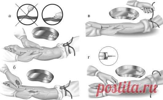 ВНУТРИВЕННАЯ ИНЪЕКЦИЯ: ПРОСТЫЕ ПРАВИЛА