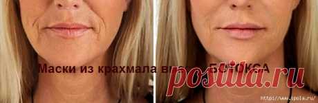 Маски из крахмала вместо БОТОКСА