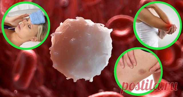 6 общих симптомов лейкемии | Совет Обратите внимание! Лейкемия обычно определяется как «рак кроветворных тканей организма». Болезнь чаще всего поражает лейкоциты, которые мутируют и становятся раковыми. Эти клетки в основном производятся в костном мозге,...