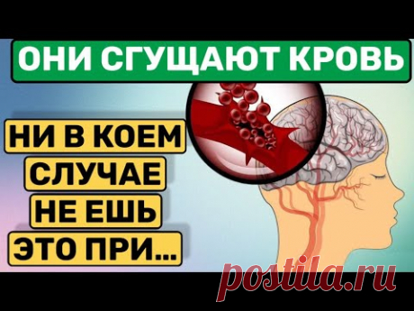 ОСТОРОЖНО - ТРОМБЫ ! КАКИЕ ПРОДУКТЫ ЗАГУЩАЮТ КРОВЬ И ДЕЛАЮТ ТРОМБЫ!!!