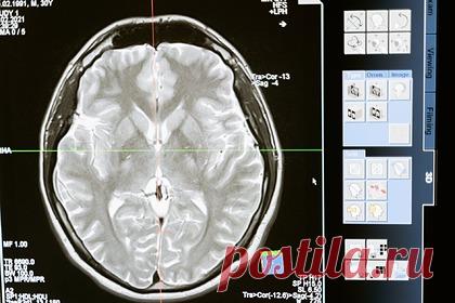 Названы ускоряющие старение мозга три продукта. Диетолог Серена Пун рассказала о нескольких продуктах, негативно влияющих на работу мозга. Эксперт объяснила, что употребление слишком большого количества сахара ухудшает память и увеличивает риск слабоумия. По ее словам, сахар сейчас можно найти везде: от напитков и десертов до заправок для салатов.