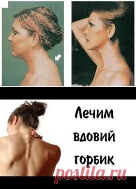 "Вдовий горбик": такое безобразие нам ни к чему!