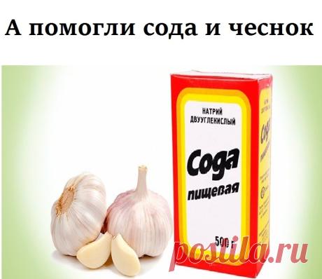 А помогли сода и чеснок - Рецепты