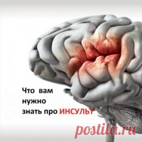 инсульт