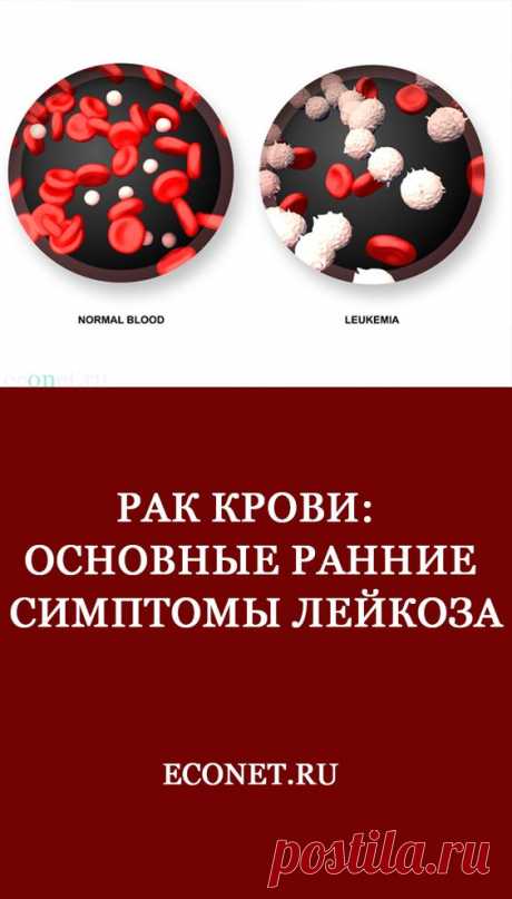 Рак крови: Основные ранние симптомы лейкоза

✅Врач-хирург Марк Истомин расскажет в этой статье вам об основных ранних симптомах ЛЕЙКОЗА – рака крови. Будьте внимательны к своему здоровью!