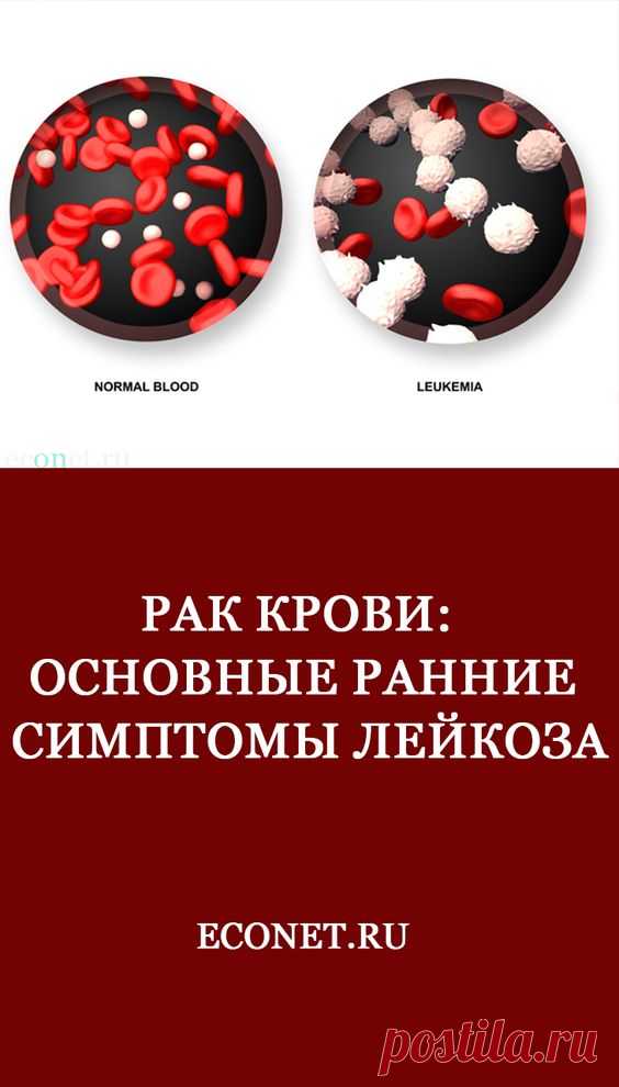 Рак крови: Основные ранние симптомы лейкоза

✅Врач-хирург Марк Истомин расскажет в этой статье вам об основных ранних симптомах ЛЕЙКОЗА – рака крови. Будьте внимательны к своему здоровью!