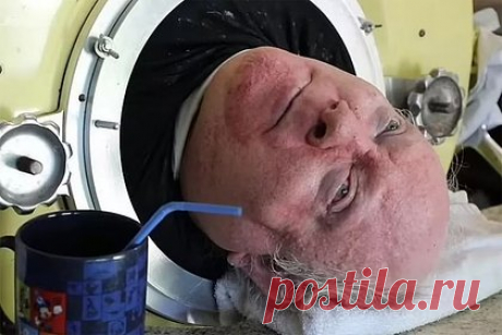 Мужчина 72 года прожил в железной капсуле из-за опасной болезни. В США мужчина 72 года провел в барокамере из-за того, что в шесть лет заразился полиомиелитом. Несмотря на все ограничения, Александер вел относительно активный образ жизни: передвигался на инвалидной коляске и посещал судебные заседания. В понедельник, 11 марта, Александер завершил свой земной путь.