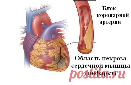 Пейте воду на пустой желудок сразу после пробуждения!