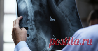 В позвоночнике женщины выросло гнездо паразитов: омерзительная находка Врачи обнаружили в позвоночном столбе 35-летней жительницы Франции гроздь цист собачьего ленточного червя, из-за которых пациентка потеряла способность ходить.