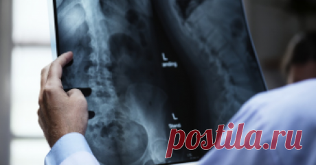 В позвоночнике женщины выросло гнездо паразитов: омерзительная находка Врачи обнаружили в позвоночном столбе 35-летней жительницы Франции гроздь цист собачьего ленточного червя, из-за которых пациентка потеряла способность ходить.