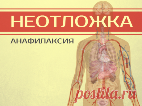 Анафилактический шок, что делать? Неотложная помощь при анафилактическом шоке

Анафилактический шок – самая быстрая и опасная аллергическая реакция. После контакта с аллергеном анафилаксия в течение нескольких минут может привести к с…