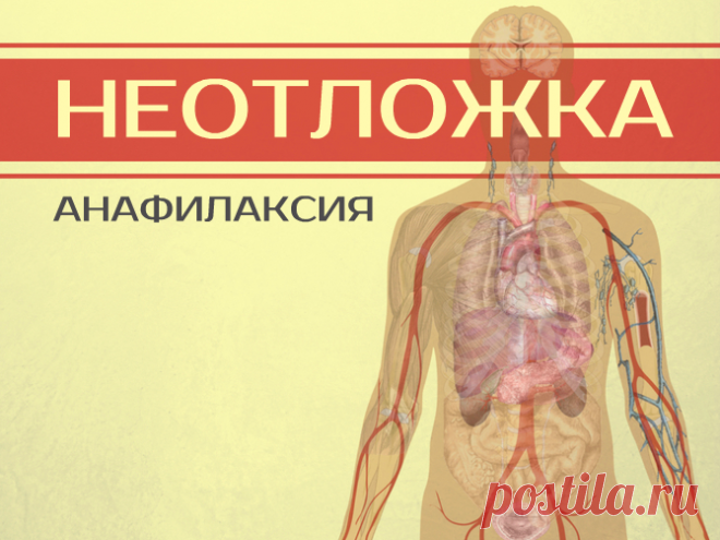 Анафилактический шок, что делать? Неотложная помощь при анафилактическом шоке

Анафилактический шок – самая быстрая и опасная аллергическая реакция. После контакта с аллергеном анафилаксия в течение нескольких минут может привести к с…