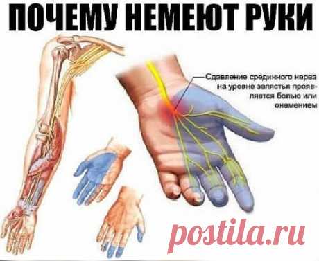 Почему немеют руки: 7 причин, заставляющих задуматься о здоровье.